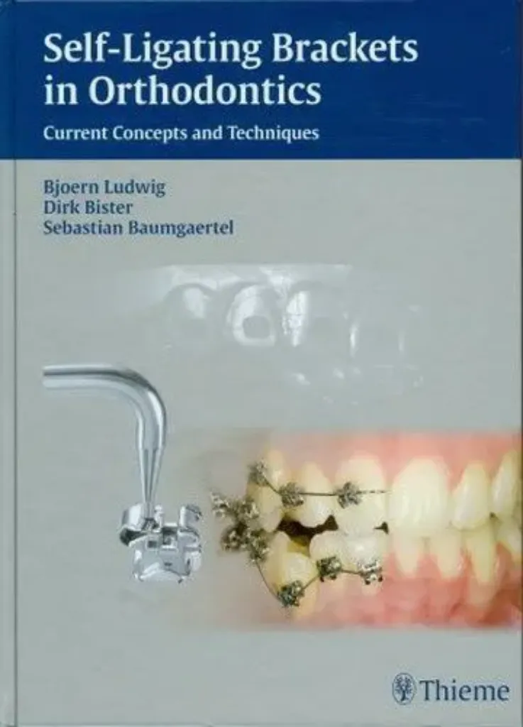 Imagem de Self-ligating Brackets in Orthodontics: Current Concepts and Techniques