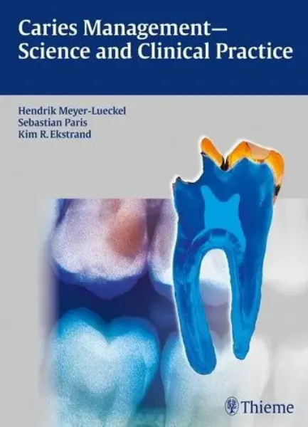 Imagem de Caries Management - Science Clinical Practice
