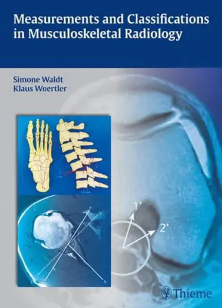 Imagem de Measurements and Classifications In Musculoskeletal Radiology