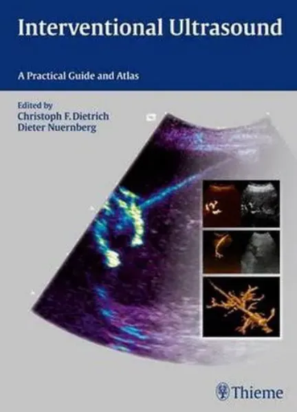 Imagem de Interventional Ultrasound