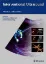 Imagem de Interventional Ultrasound