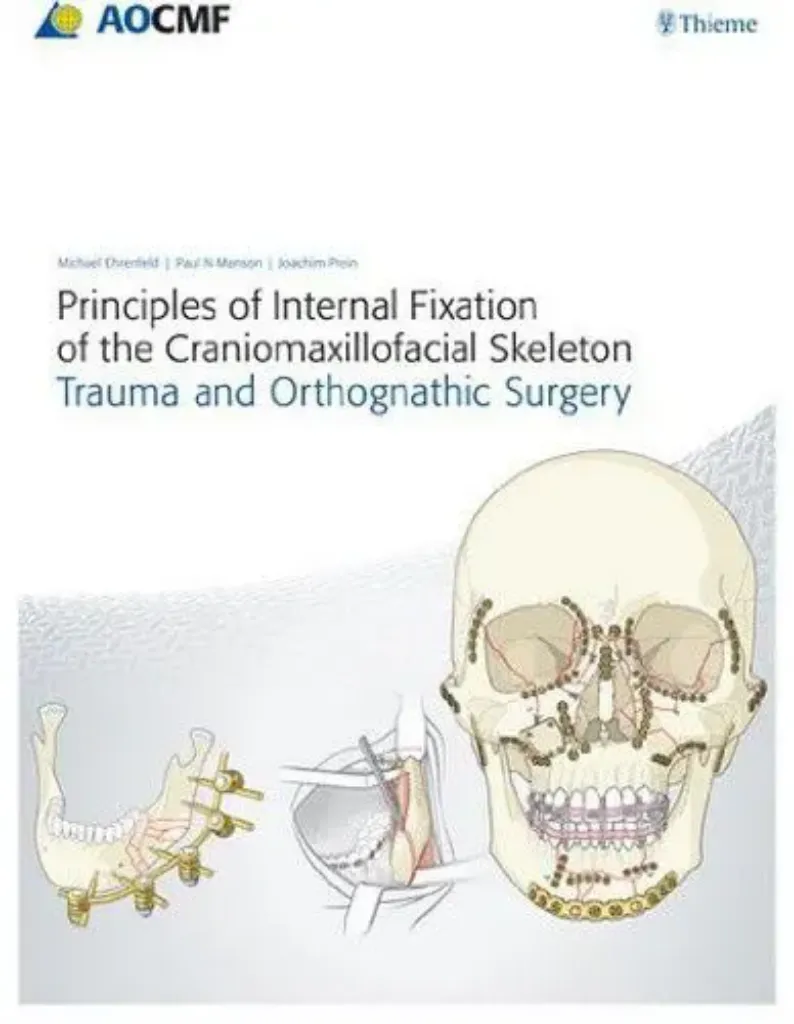 Imagem de Principles of Internal Fixation of The Craniomaxillofacial 2