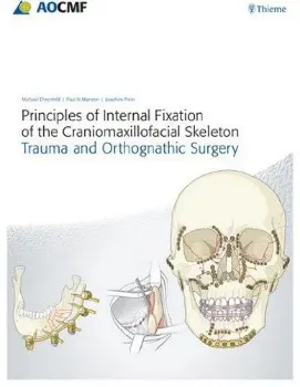 Picture of Book Principles of Internal Fixation of The Craniomaxillofacial 2