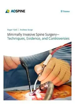 Imagem de Minimally Invasive Spine Surgery: Techniques, Evidence and Controversies