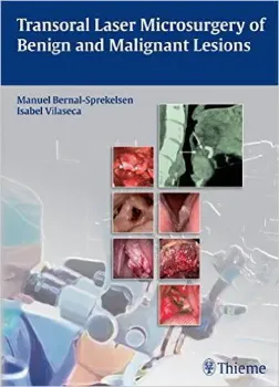 Picture of Book Transoral Laser Microsurgery of Benign and Malignant Lesions