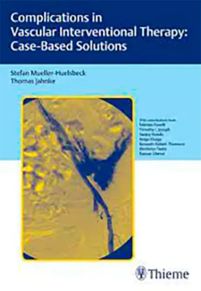 Imagem de Complications in Vascular Interventional Therapy: Case-Based Solutions