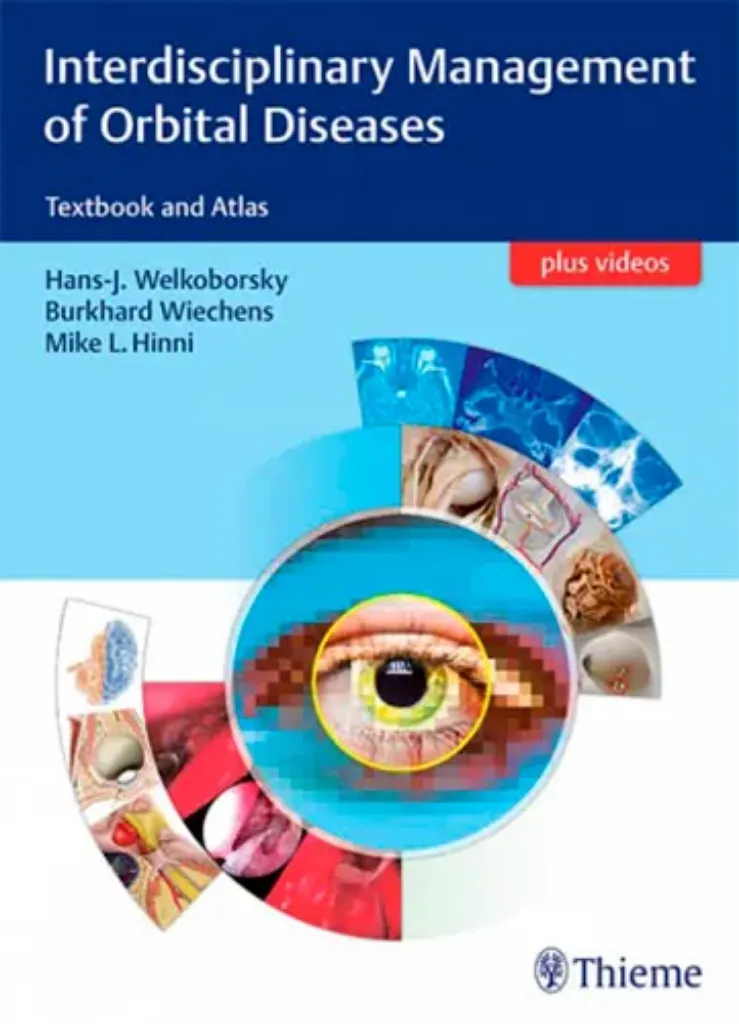 Imagem de Interdisciplinary Management of Orbital Diseases: Textbook and Atlas