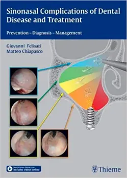 Imagem de Sinonasal Complications of Dental Disease and Treatment: Prevention - Diagnosis - Management