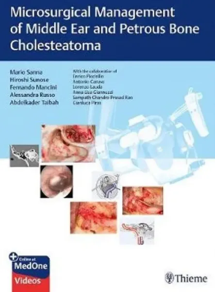 Imagem de Microsurgical Management of Middle Ear and Petrous Bone Cholesteatoma