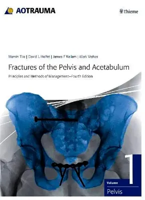 Imagem de Fractures of the Pelvis and Acetabulum (AO): Principles and Methods of Management