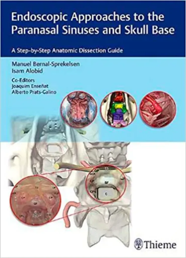 Imagem de Endoscopic Approaches to the Paranasal Sinuses and Skull Base: A Step-by-Step Anatomic Dissection Guide
