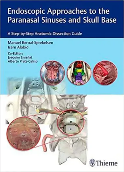 Imagem de Endoscopic Approaches to the Paranasal Sinuses and Skull Base: A Step-by-Step Anatomic Dissection Guide