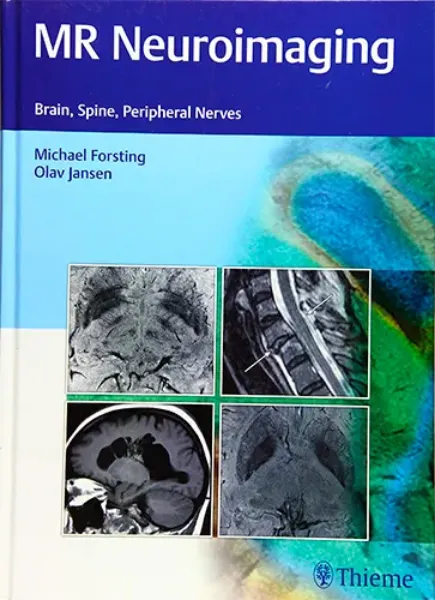 Imagem de MR Neuroimaging: Brain, Spine and Peripheral Nerves