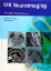 Imagem de MR Neuroimaging: Brain, Spine and Peripheral Nerves