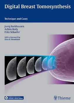 Picture of Book Digital Breast Tomosynthesis