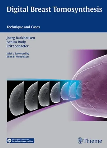 Imagem de Digital Breast Tomosynthesis