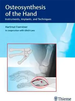 Picture of Book Osteosynthesis of the Hand: Instruments, Implants and Techniques