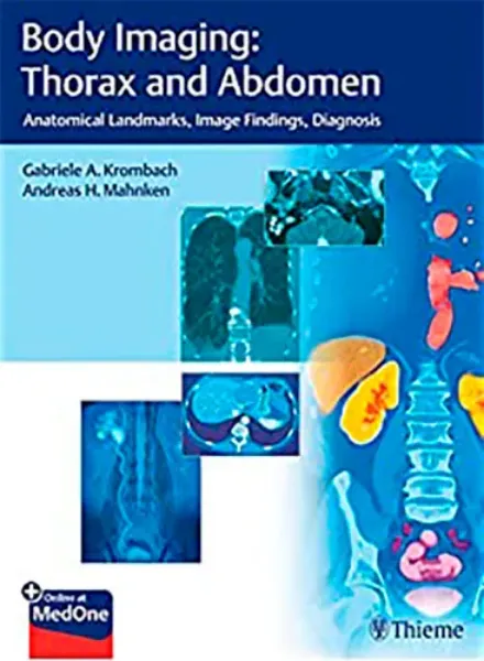 Imagem de Body Imaging: Thorax and Abdomen: Anatomical Landmarks, Image Findings, Diagnosis