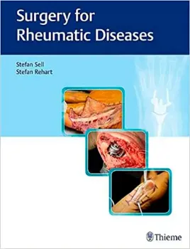 Imagem de Surgery for Rheumatic Diseases