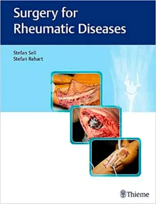 Imagem de Surgery for Rheumatic Diseases