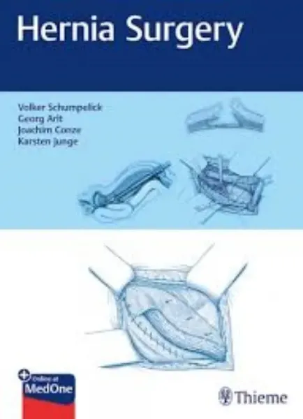 Imagem de Hernia Surgery