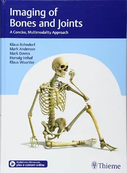 Imagem de Imaging of Bones and Joints: A Concise, Multimodality Approach