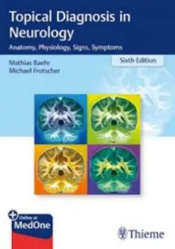 Imagem de Topical Diagnosis in Neurology: Anatomy, Physiology, Signs, Symptoms