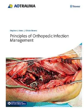 Imagem de Principles of Orthopedic Infection Management