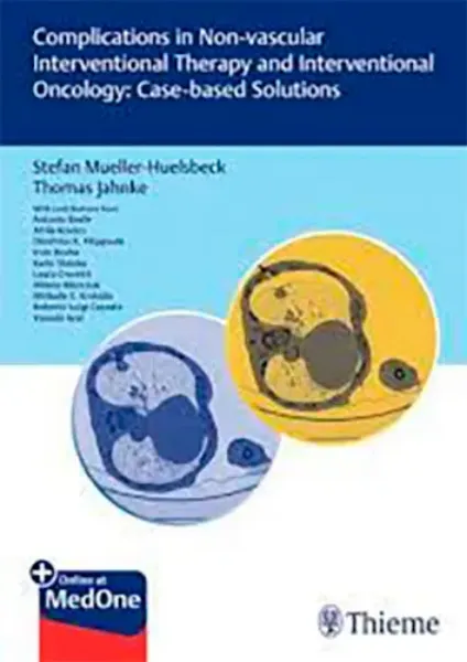 Imagem de Complications in Non-vascular Interventional Therapy and Interventional Oncology: Case-based Solutions