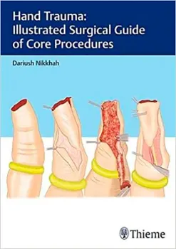 Picture of Book Hand Trauma: Illustrated Surgical Guide of Core Procedures