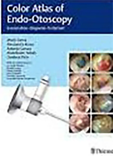 Imagem de Color Atlas of Endo-Otoscopy: Examination-Diagnosis-Treatment