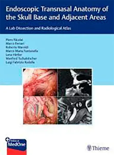 Imagem de Endoscopic Transnasal Anatomy of the Skull Base and Adjacent Areas: A Lab Dissection and Radiological Atlas