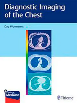 Picture of Book Diagnostic Imaging of the Chest