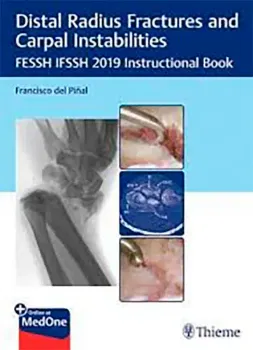 Imagem de Distal Radius Fractures and Carpal Instabilities: FESSH IFSSH 2019 Instructional Book