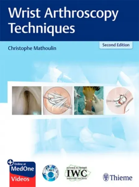 Imagem de Wrist Arthroscopy Techniques