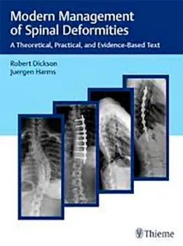 Picture of Book Modern Management of Spinal Deformities: A Theoretical, Practical and Evidence-Based Text