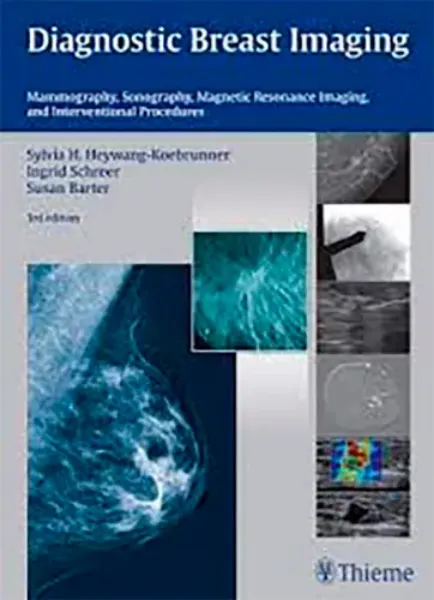 Imagem de Diagnostic Breast Imaging