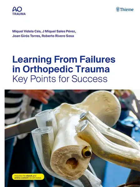 Imagem de Learning From Failures in Orthopedic Trauma: Key Points for Success