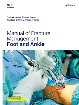 Imagem de Manual of Fracture Management - Foot and Ankle