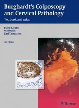 Imagem de Burghartdt's Colposcopy and Cervical Pathology: Textbook and Atlas