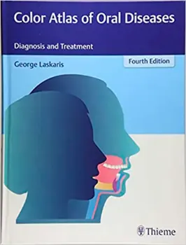 Imagem de Color Atlas of Oral Diseases: Diagnosis and Treatment