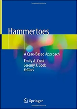 Picture of Book Hammertoes: A Case-Based Approach