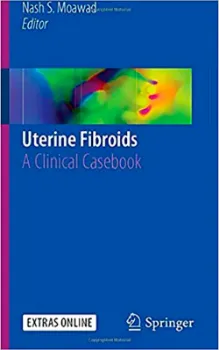 Imagem de Uterine Fibroids: A Clinical Casebook