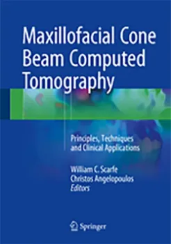 Imagem de Maxillofacial Cone Beam Computed Tomography: Principles, Techniques and Clinical Applications