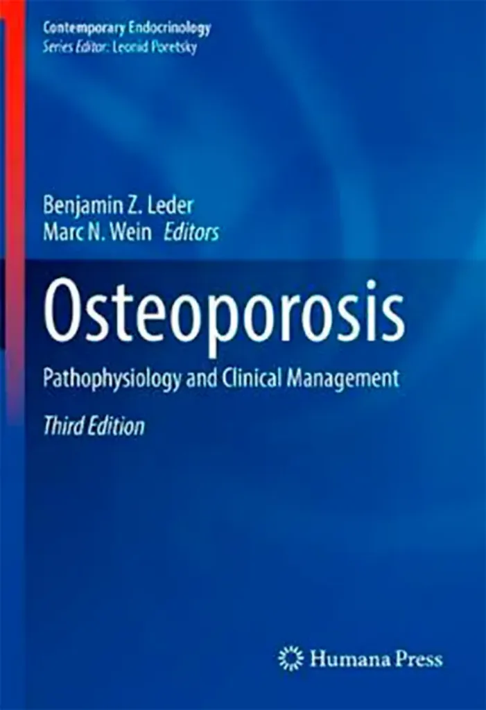 Imagem de Osteoporosis: Pathophysiology and Clinical Management