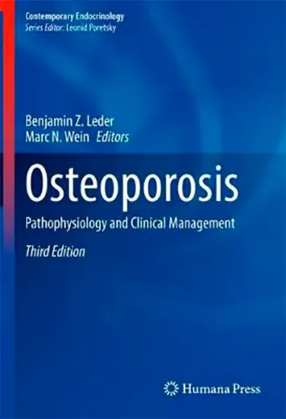 Imagem de Osteoporosis: Pathophysiology and Clinical Management