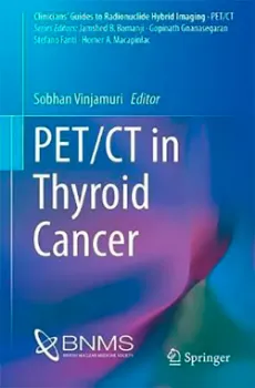 Imagem de PET/CT in Thyroid Cancer