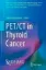 Imagem de PET/CT in Thyroid Cancer