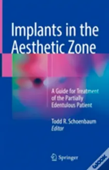 Imagem de Implants in the Aesthetic Zone: A Guide for Treatment of the Partially Edentulous Patient