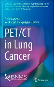 Picture of Book PET/CT in Lung Cancer